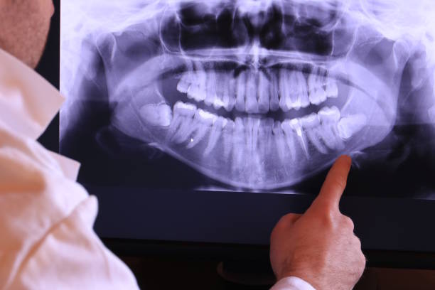 Best Holiday Emergency Dentist in Fremont, MI