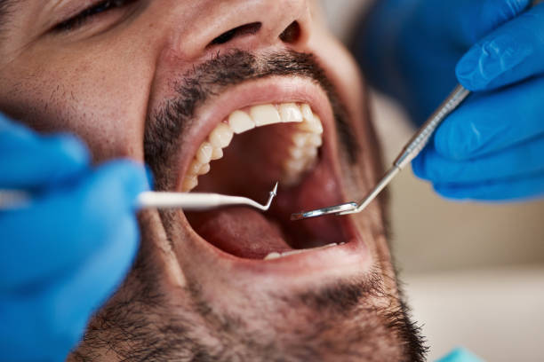 Best Emergency Dental Care for Abscessed Tooth in Fremont, MI